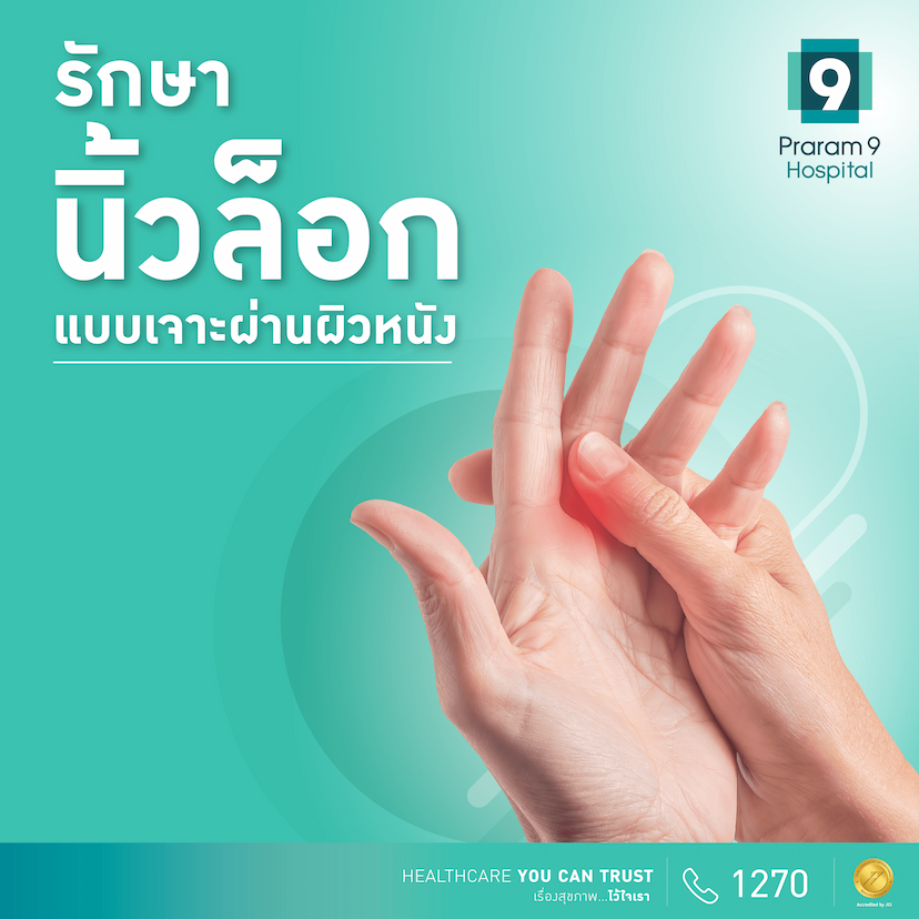 รักษานิ้วล๊อกแบบเจาะผ่านผิวหนัง 